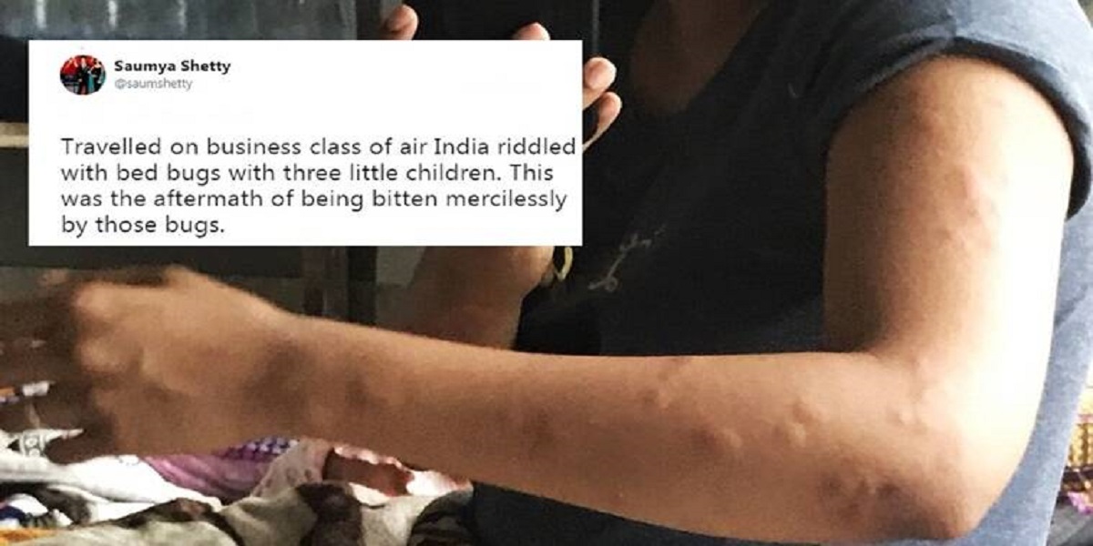 Bed bug bites: Air India offers ‘waiver’ rather than ‘refund’ to the tourist